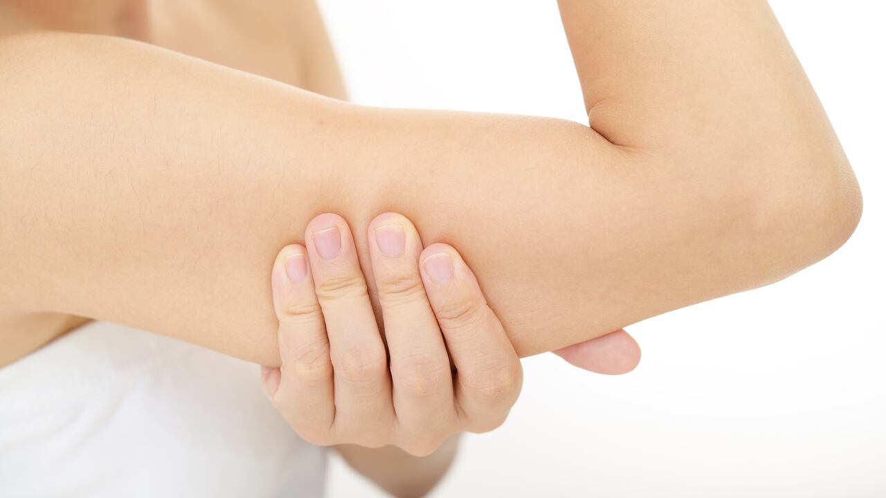 La flacidez en los brazos puede mejorarse con ejercicio.