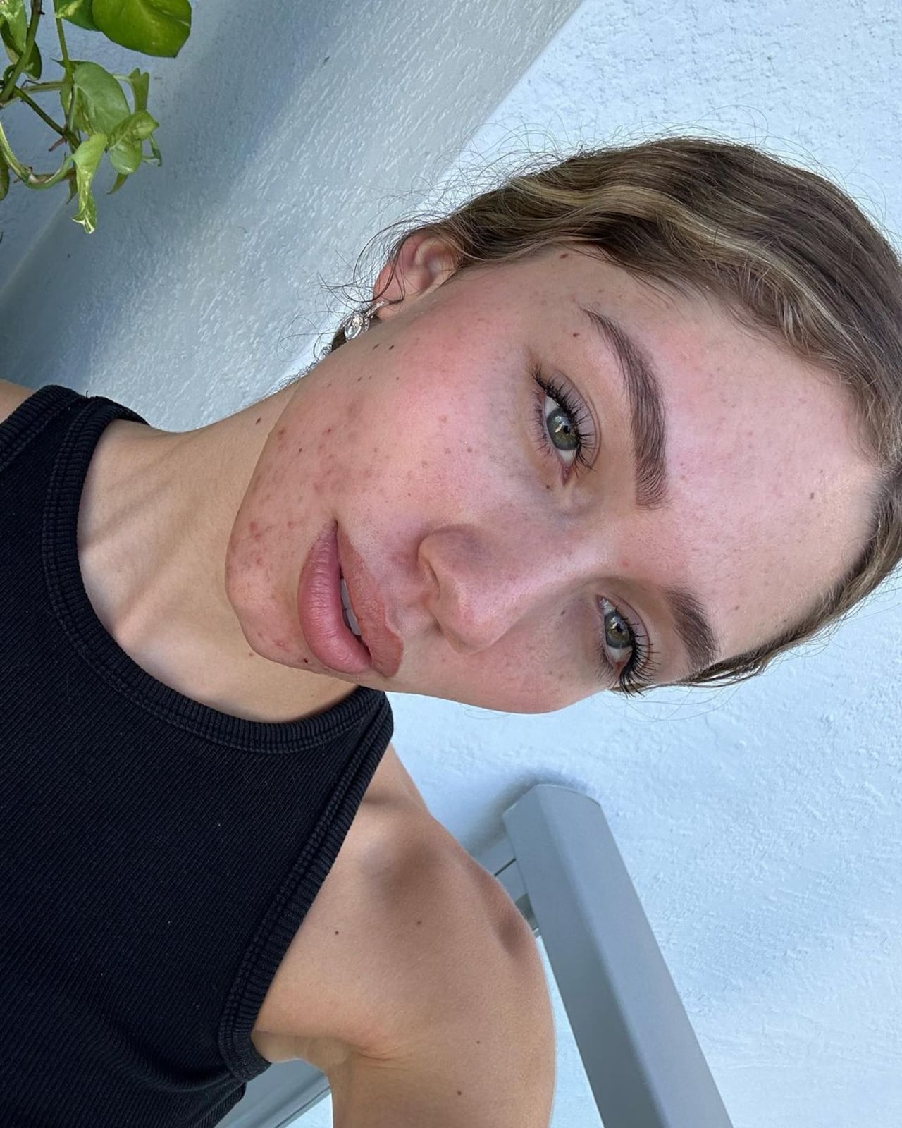 Luna Pernía mostró que su piel está teniendo cambios