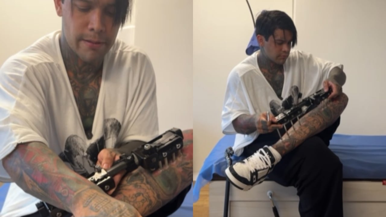 El influencer mostró cómo quedaron las piernas.