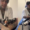 El influencer mostró cómo quedaron las piernas.