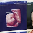 Twitter:@RoglanAntonella