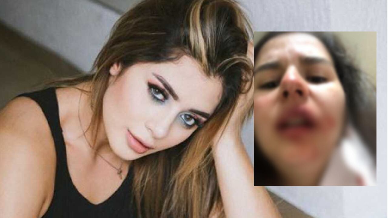 Así fue la agresión de la hija de Marbelle a otra mujer - Semana