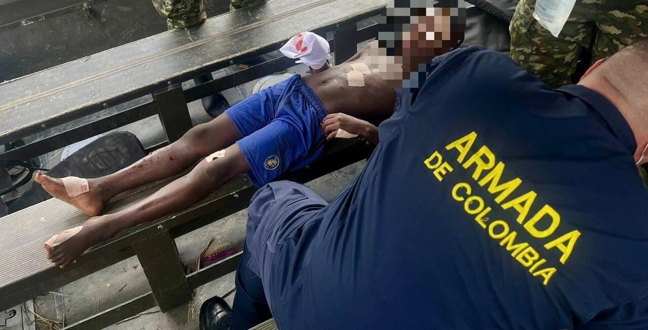 Niño herido por mina antipersona del ELN en Chocó.