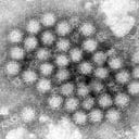 ARCHIVO - Esta imagen de microscopio electrónico facilitada por los Centros para el Control y la Prevención de Enfermedades de Estados Unidos (CDC, por sus siglas en inglés) muestra un grupo de viriones de norovirus. (Charles D. Humphrey/CDC vía AP, Archivo)