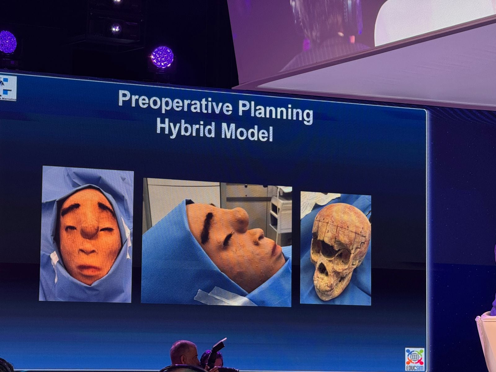 La pequeña oriunda de la región del Amazonas sueña con ser médica neurocirujana.