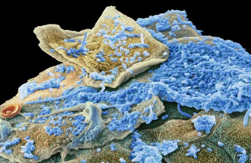 El MEB puede aumentar los especímenes hasta un millón de veces y captar una imagen en 3D utilizando electrones que ofrecen una visión única.