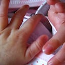Médicos de varios países lograron lo que parecía imposible para las hermanitas.