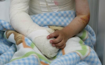 En Armenia, Quindío, fue reportada la primera víctima del uso de pólvora de la temporada decembrina. 