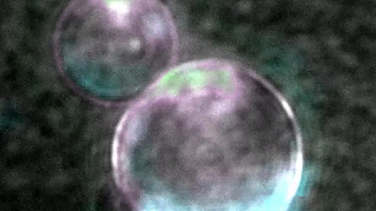 Imagen de superresolución de los liposomas de SpudCell, con el genoma encapsulado y expresión activa de proteínas.