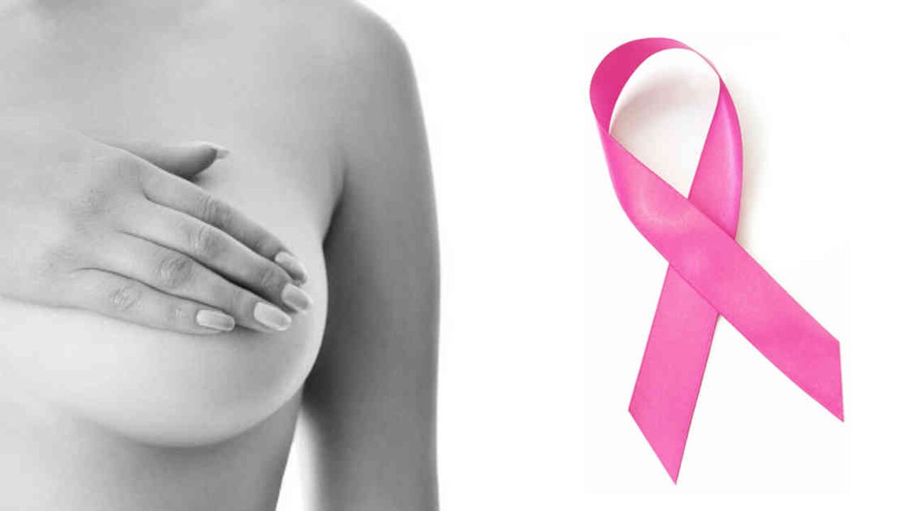 En Colombia cada año se diagnostican al rededor de 7.000 casos de mujeres con cáncer de mama.