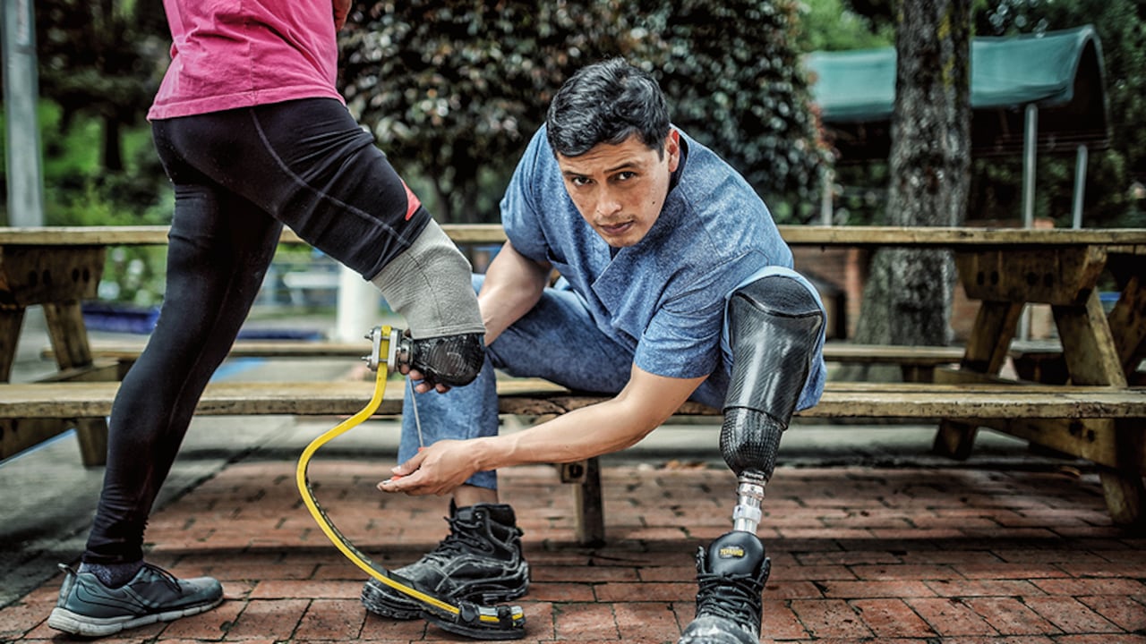 Una prótesis es una extensión artificial que reemplaza o provee una parte del cuerpo que falta por diversas razones.