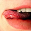 La mayoría de veces cuando se presentan manchas negras en la lengua, son inofensivas.