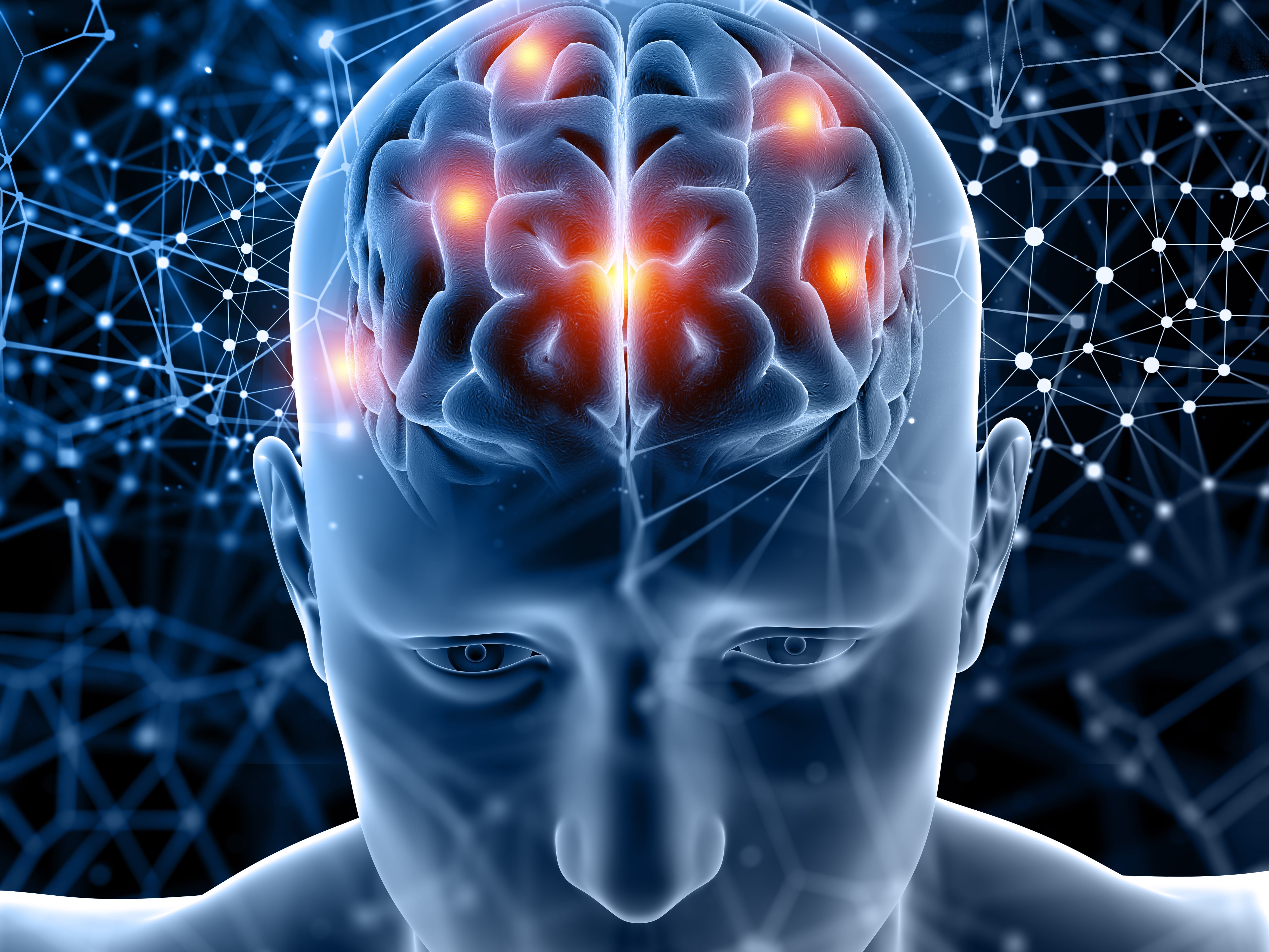 En la atención de un ataque cerebrovascular el tiempo vale oro