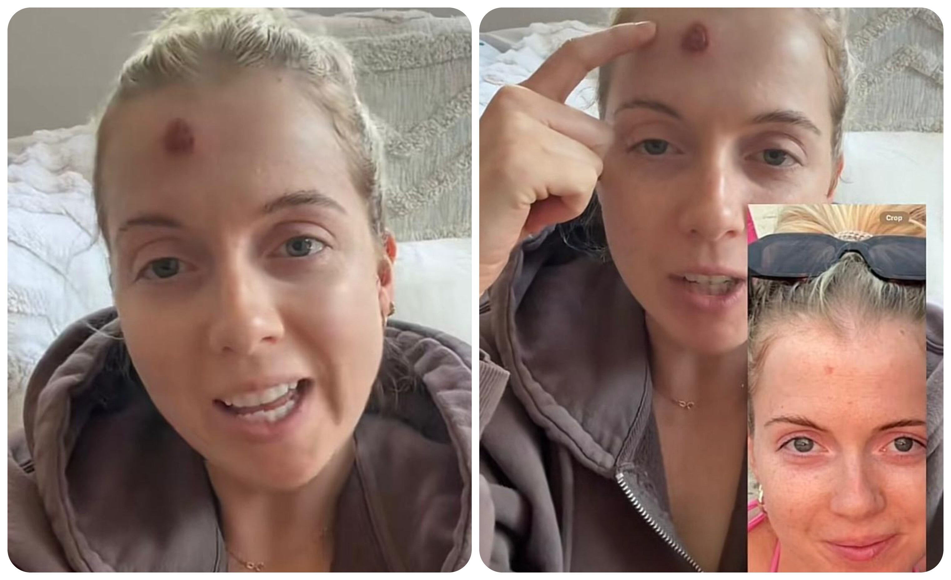 La mujer se dio cuenta de que tenía cáncer después de una biopsia