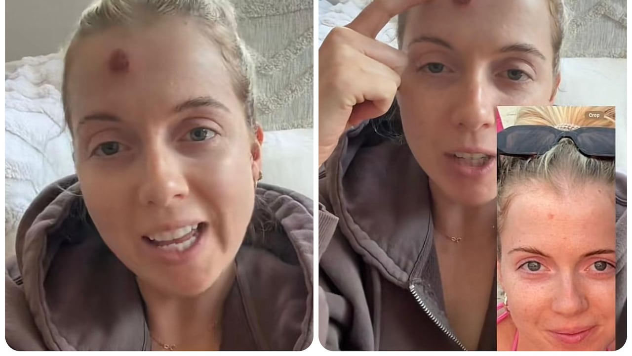 La mujer se dio cuenta de que tenía cáncer después de una biopsia