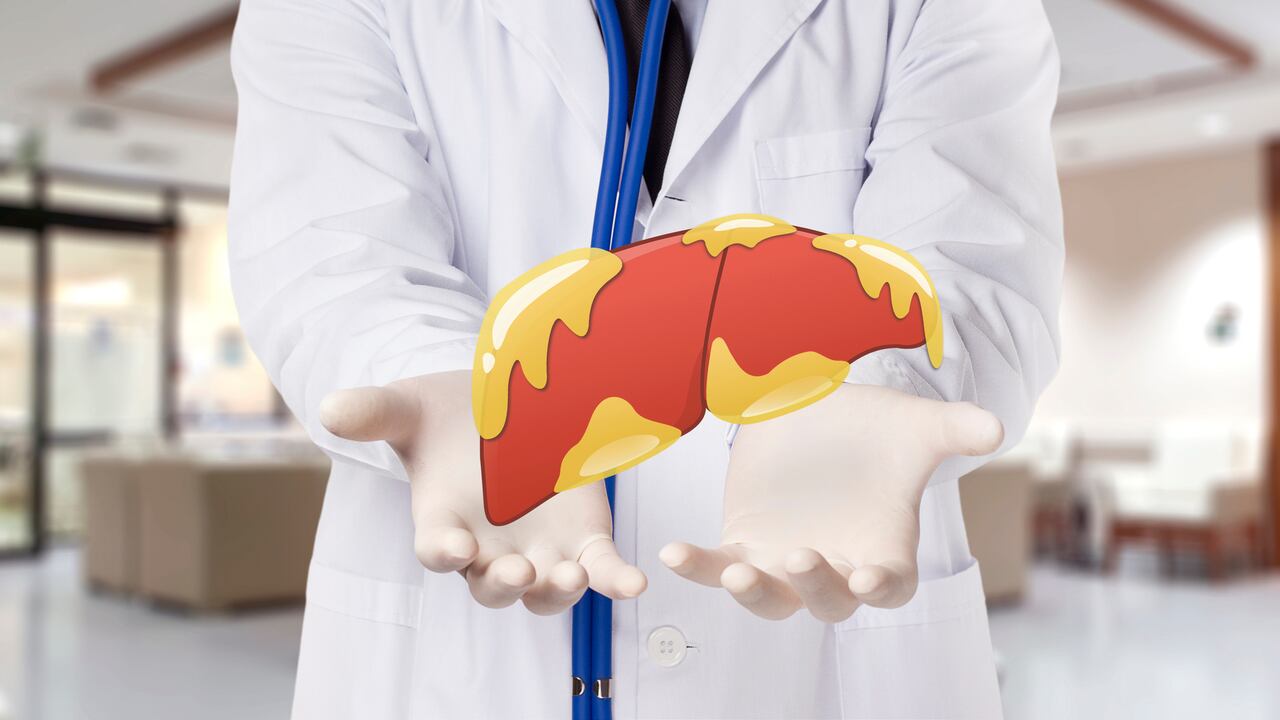 El hígado graso se puede presentar por la ingesta de una alimentación inadecuada.