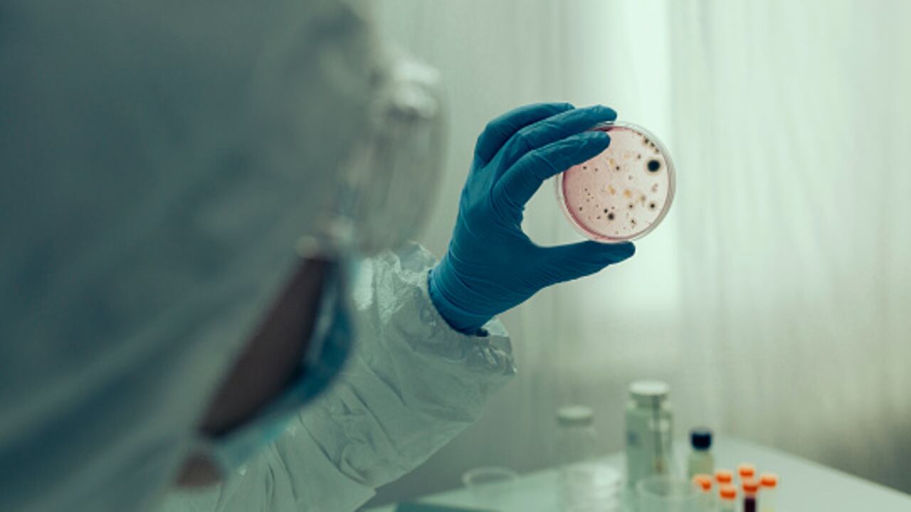 Los casos de cólera en el mundo registraron un aumento considerable durante mayo de 2024. Imagen de referencia.