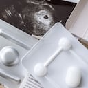 En la consulta del ginecólogo se pueden ver medicamentos para interrumpir el embarazo delante de una imagen ecográfica.