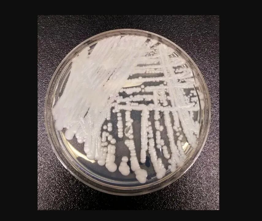 Vista microscópica del hongo.