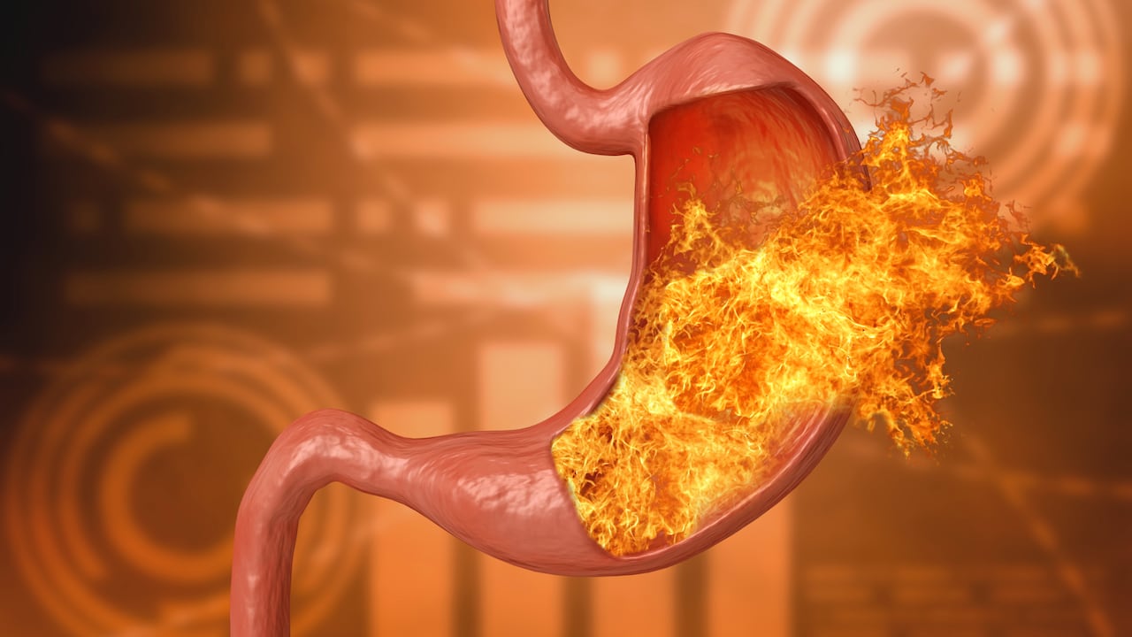 Alimentos indispensables para prevenir la acidez estomacal.