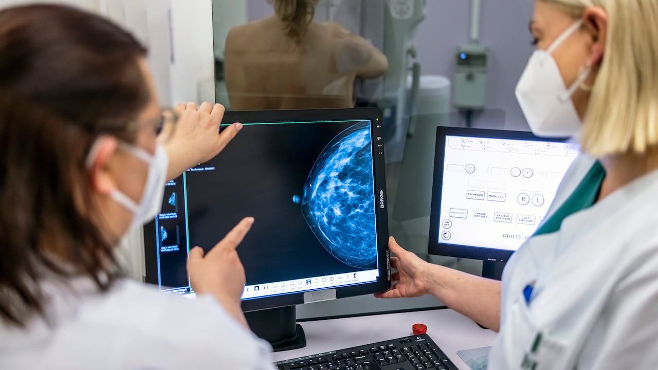 Diagnosticar el cáncer de mama en etapas tempranas ayuda a que la supervivencia, luego de 5 años, esté en promedio entre el 72 y el 91 por ciento