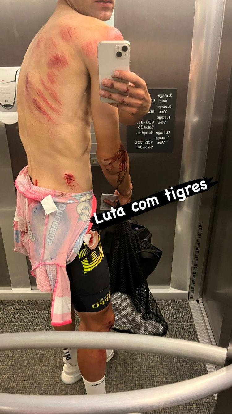 Tour de Francia 2022: así quedó la espalda de Ruben Guerreiro (EF Education) tras la caída masiva de la etapa 2