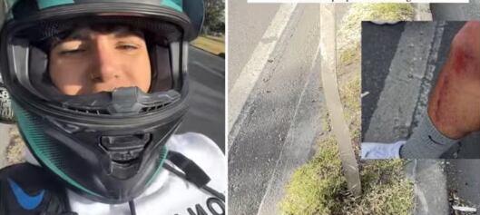 Carballo, exparticipante del Desafío, tuvo accidente en moto.