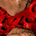 Colesterol alto, riesgo de ataque cardíaco.