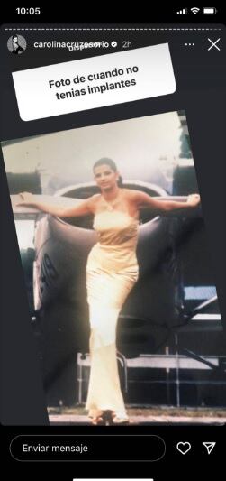 Carolina Cruz reveló foto antes de que tuviera implantes en los senos.