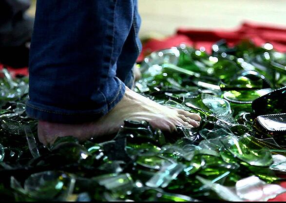 La insensibilidad al dolor es una de las llamadas “enfermedades raras”. / referencia