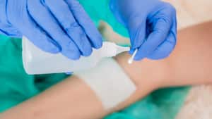 Alcohol vs. agua oxigenada, ¿cuál es la mejor opción?