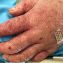 En el departamento se han reportado casi mil casos de dengue.