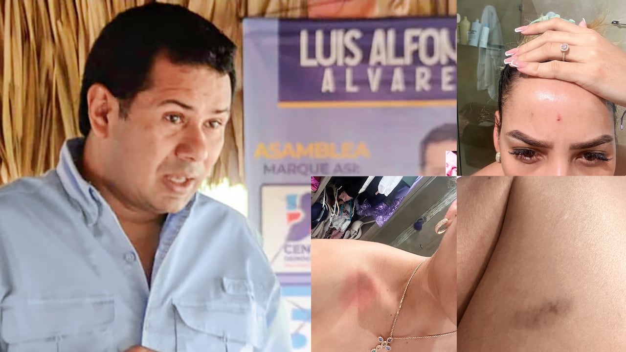 Luis Alfonso Álvarez fue elegido en 2023 para la Asamblea Departamental de Sucre con cerca de 16.000 votos. Recibió el aval del Centro Democrático.