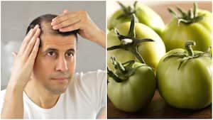 Algunas preparaciones naturales pueden ser efectivas para tratar problemas en el cuerpo cabelludo.