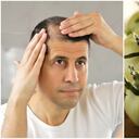 Algunas preparaciones naturales pueden ser efectivas para tratar problemas en el cuerpo cabelludo.