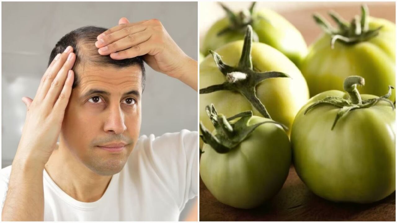 Algunas preparaciones naturales pueden ser efectivas para tratar problemas en el cuerpo cabelludo.