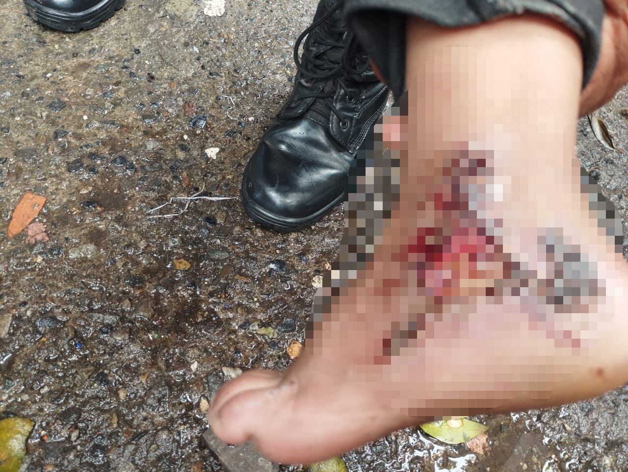 Niño indigena lleva días con quemaduras y en La Rioja no permiten su traslado a un hospital