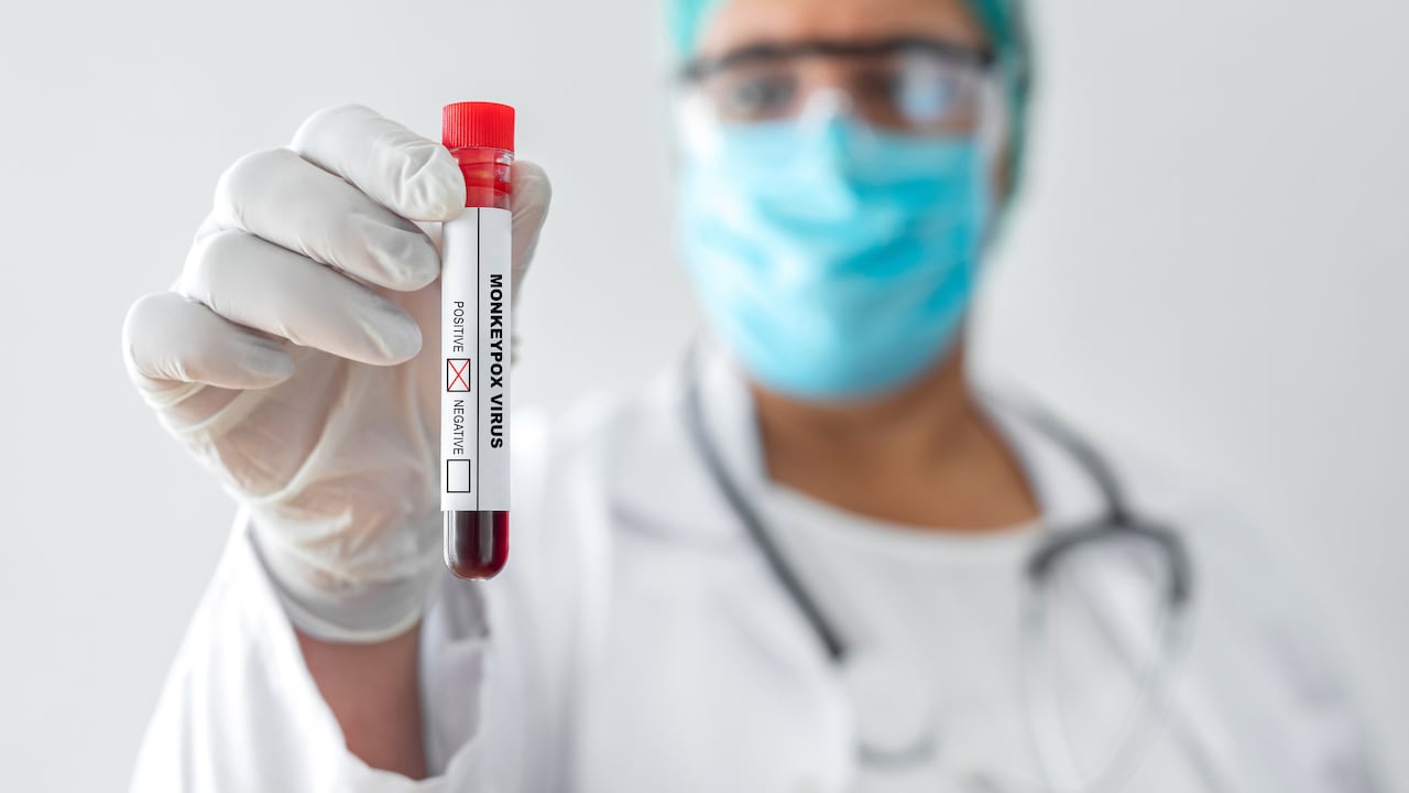 Foto de referencia sobre el virus del mono