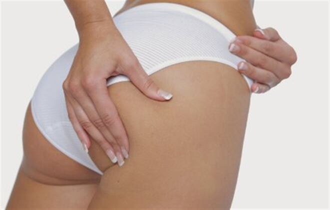 Las estrías son rayas que pueden aparecer en diferentes partes del cuerpo, como el abdomen, los glúteos, las caderas, las mamas, etc. 