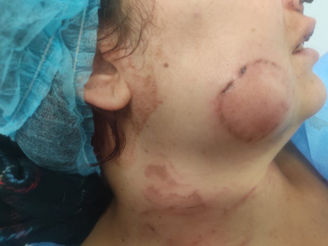 A la cárcel el hombre que, en Bogotá, atacó a mordiscos a su esposa y la dejó encerrada