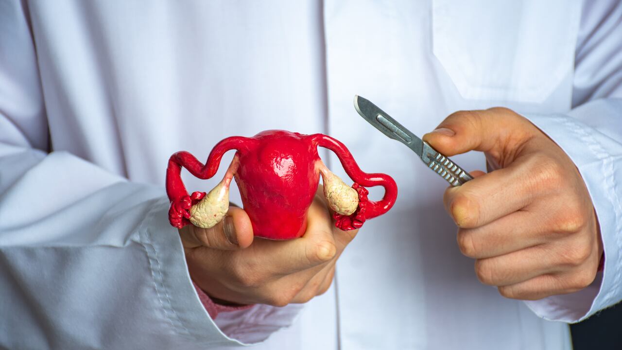 Foto referencia sobre ovarios