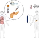 El estudio entra en su última fase para el tratamiento del cáncer de páncreas localmente avanzado mediante el uso de nanopartículas magnéticas
VHIO
(Foto de ARCHIVO)
25/2/2021