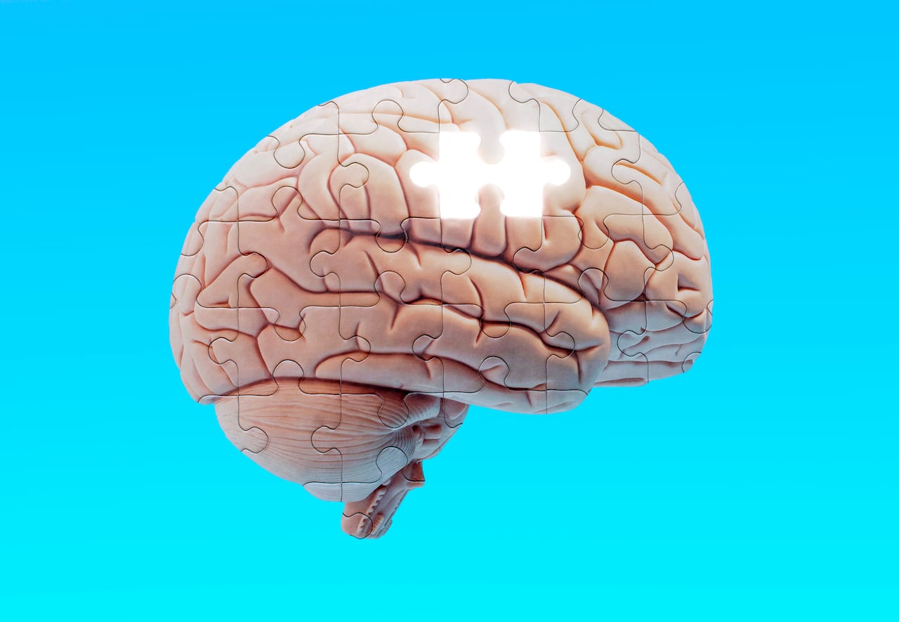 Foto de referencia sobre alzhéimer