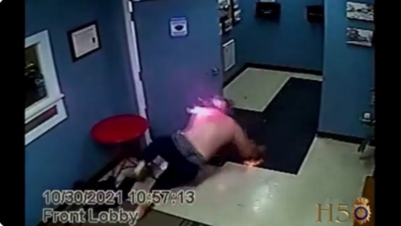 Un hombre sufrió quemaduras de cara y torso luego de rociarse gel antibacterial y recibir una descarga eléctrica por parte de la policía