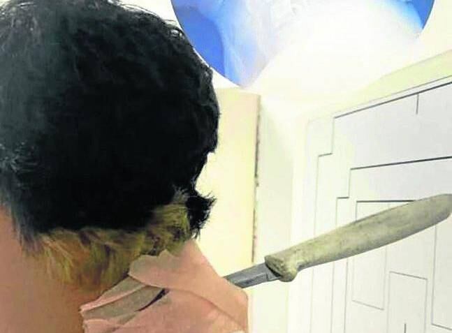 Así quedó la víctima.