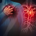 Colesterol y triglicéridos altos: ¿Cuáles son los síntomas?