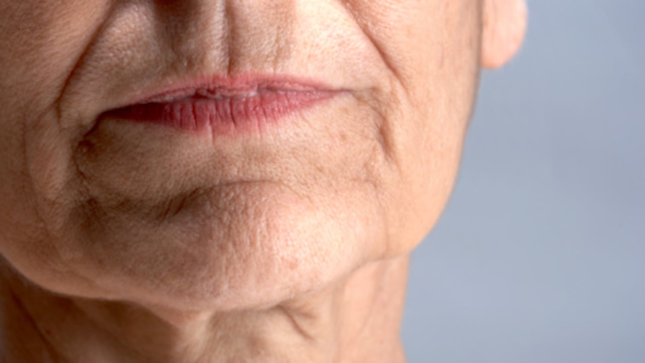 Las arrugas en la boca pueden surgir por una precaria hidratación.