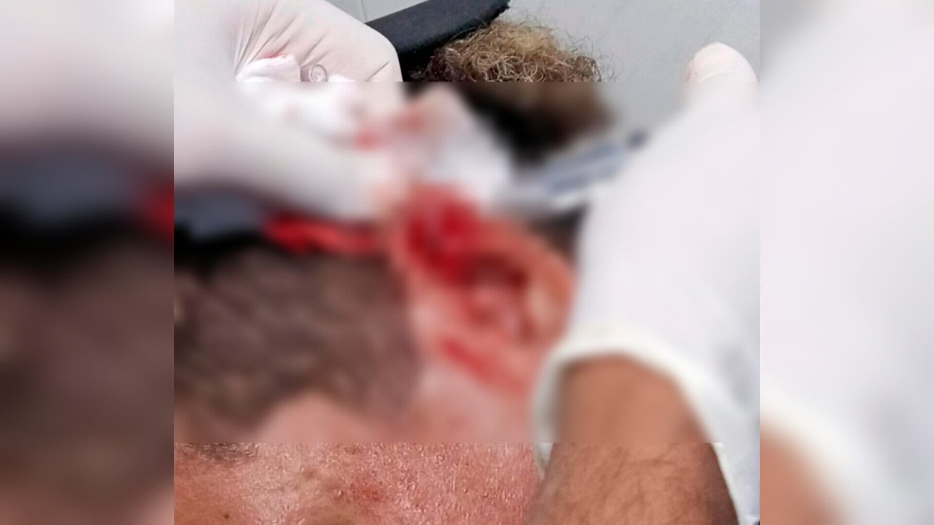 Contratista agredido en Cartagena