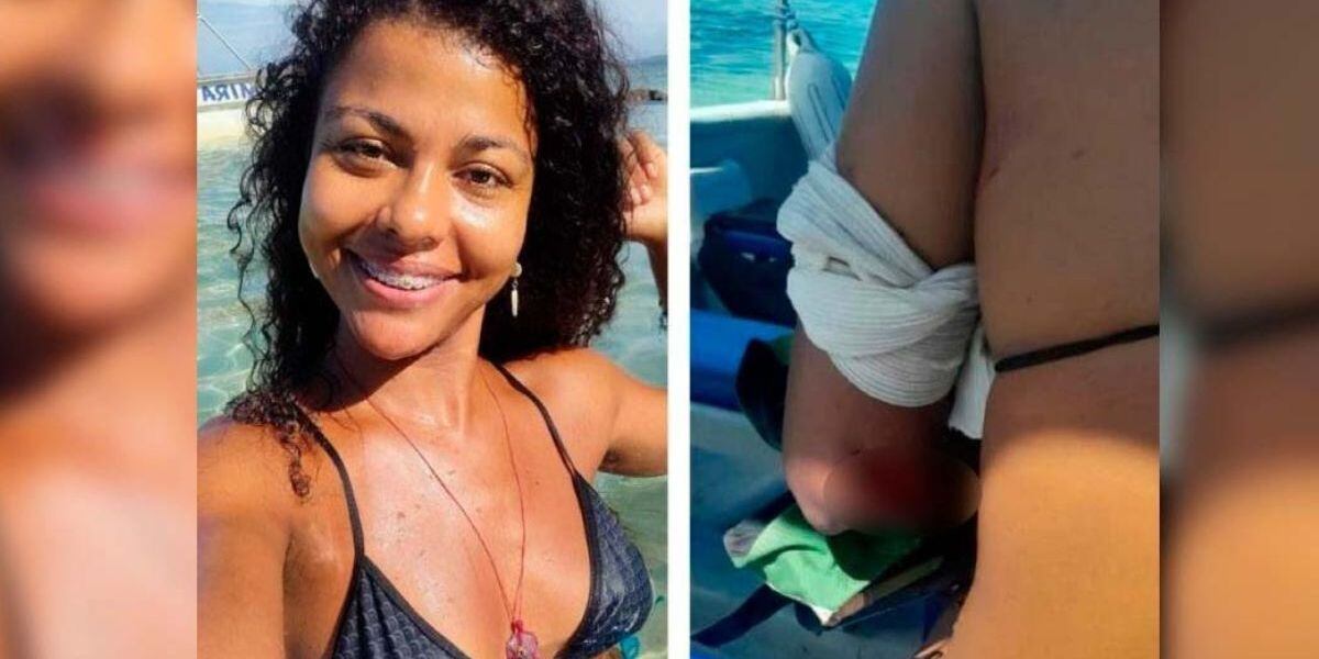 La joven sufrió graves heridas en el brazo y costado izquierdo.