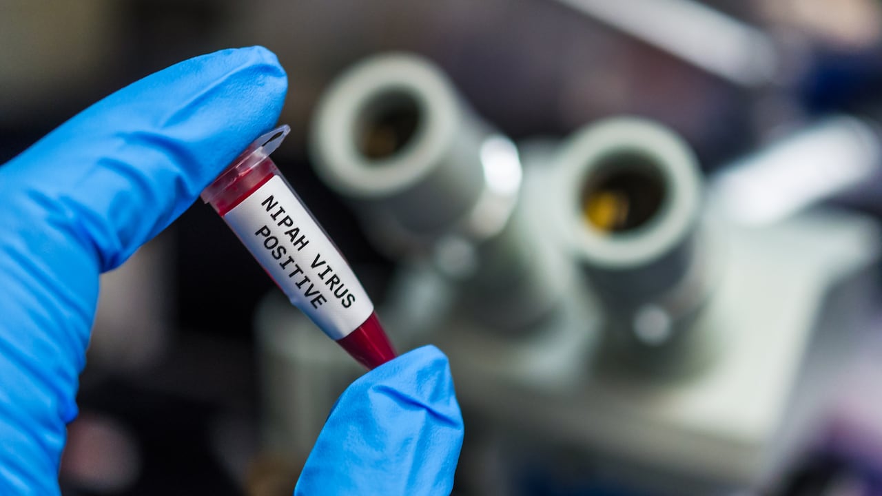 Personal sanitario realiza controles preventivos en aeropuertos asiáticos tras la detección de nuevos casos de virus Nipah en India